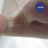 Footlogix Peeling Skin Formula