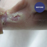 Footlogix Peeling Skin Formula