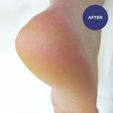 Footlogix Rough Skin Formula