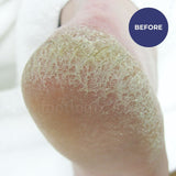 Footlogix Rough Skin Formula